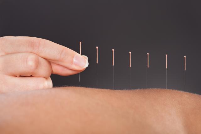Nauènici besni zbog akupunkture na bebama